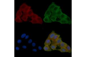 ABIN6261665 and ABIN6278570 staining Hela cells(24h of starvation treatment) by IF/ICC.