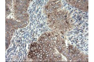 anti-Diphthamide Biosynthesis Protein 2 (DPH2) antibody