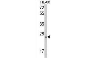Western Blotting (WB) image for anti-serine/arginine-Rich Splicing Factor 1 (SRSF1) antibody (ABIN3002838) (SRSF1 anticorps)