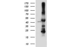 Western Blotting (WB) image for anti-serpin Peptidase Inhibitor, Clade B (Ovalbumin), Member 6 (SERPINB6) antibody (ABIN1500892) (SERPINB6 anticorps)