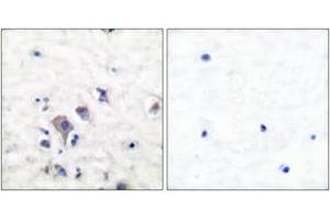 Immunohistochemistry analysis of paraffin-embedded human brain tissue, using mGluR2/3 Antibody. (mGluR2/3 anticorps  (AA 823-872))