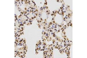 Immunohistochemistry (IHC) image for anti-Histone H3 (H3) (H3R17me) antibody (ABIN3023283)