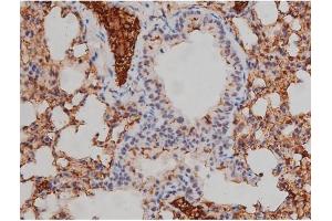 ABIN6267331 at 1/200 staining Mouse brain tissue sections by IHC-P.