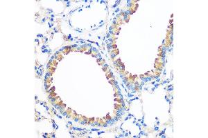 Immunohistochemistry of paraffin-embedded Mouse lung using  Rabbit pAb (ABIN6131176, ABIN6136646, ABIN6136647 and ABIN6222857) at dilution of 1:100 (40x lens).