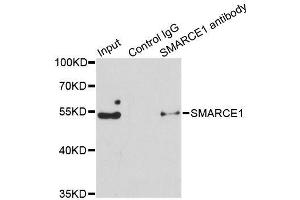 Immunoprecipitation analysis of 150ug extracts of Jurkat cells using 3ug SMARCE1 antibody. (SMARCE1 anticorps  (AA 1-411))