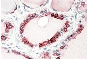 AP31571PU-N (5µg/ml) staining of paraffin embedded Human Thyroid Gland. (Thyroperoxidase anticorps  (C-Term))