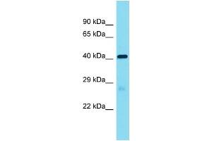 Host:  Rabbit  Target Name:  Lrrc19  Sample Type:  Mouse Heart lysates  Antibody Dilution:  1. (LRRC19 anticorps  (Middle Region))