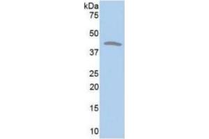 WB of Protein Standard: different control antibodies against Highly purified E. (CKM Kit ELISA)
