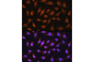 Immunofluorescence analysis of L929 cells using 67 kDa Laminin Receptor Rabbit pAb (ABIN6128199, ABIN6147247, ABIN6147248 and ABIN6224857) at dilution of 1:100 (40x lens).