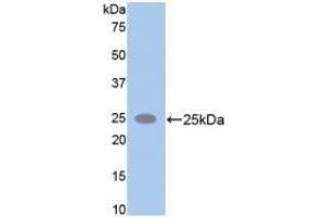 Detection of Recombinant SPTAN1, Rat using Polyclonal Antibody to Alpha-Fodrin (SPTAN1) (SPTAN1 anticorps  (AA 2071-2269))