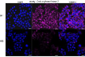 Immunocytochemical staining of HeLa cells using Acetyl-CoA acyltransferase 2 antibody (ABIN7797441), 1:1,000), Top panel: wild-type (WT), Bottom panal: Acetyl-CoA acyltransferase 2 shRNA knockdown (KD).