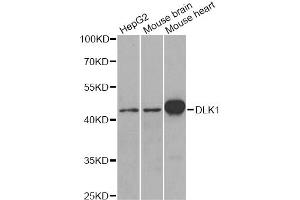 Western blot analysis of extracts of various cell lines, using DLK1 antibody. (DLK1 anticorps)