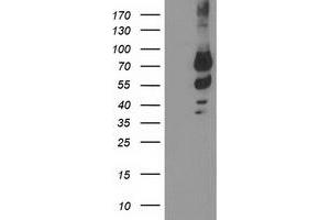 Western Blotting (WB) image for anti-Katanin P80 (WD Repeat Containing) Subunit B 1 (KATNB1) antibody (ABIN1498986) (KATNB1 anticorps)