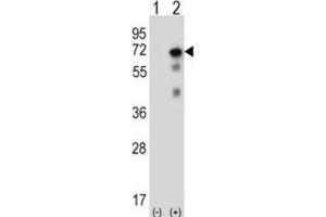 Western Blotting (WB) image for anti-Ubiquitin Specific Peptidase 2 (USP2) antibody (ABIN3001466) (USP2 anticorps)