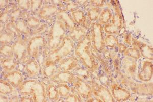 Anti-CXCR3 Picoband antibody,  IHC(P): Rat Kidney Tissue (CXCR3 anticorps  (AA 1-368))