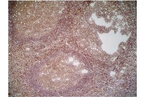 Immunoperoxidase staining of a human tonsil cryosection with Mouse anti Human CD70 antibody, clone Bu69 followed by the Histar setection system. (CD70 anticorps)