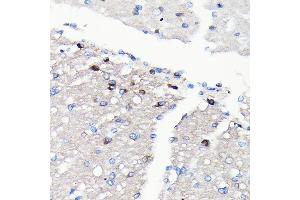 Immunohistochemistry of paraffin-embedded rat brain using NMDA Rabbit mAb (ABIN7267420) at dilution of 1:100 (40x lens). (NMDAR2A anticorps)