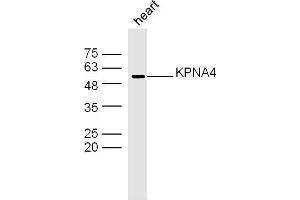 Mouse heart lysates probed with KPNA4 Polyclonal Antibody, Unconjugated  at 1:300 dilution and 4˚C overnight incubation. (KPNA4 anticorps  (AA 1-100))