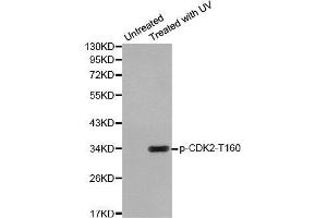 Western blot analysis of extracts from Hela cells using Phospho-CDK2-T160 antibody. (CDK2 anticorps  (pThr160))