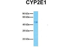 Host:  Rabbit  Target Name:  CYP2E1  Sample Tissue:  Human Fetal Lung  Antibody Dilution:  1. (CYP2E1 anticorps  (C-Term))