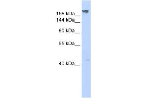 WB Suggested Anti-DYSF Antibody Titration:  0. (Dysferlin anticorps  (Middle Region))