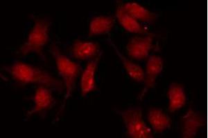 ABIN6267285 staining MDA-MB-231 by IF/ICC.