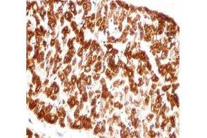 DES / Desmin antibody immunohistochemistry analysis in formalin fixed and paraffin embedded human heart tissue.