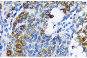 Immunohistochemistry of paraffin-embedded Rat ovary using PTCH1 Polyclonal Antibody at dilution of 1:100 (40x lens). (Patched 1 anticorps)