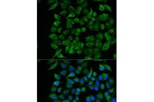 Immunofluorescence analysis of U2OS cells using PAEP Polyclonal Antibody (PAEP anticorps)
