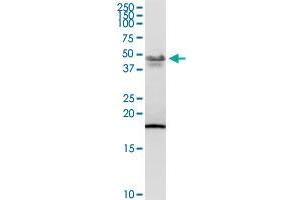 PCYT1B MaxPab rabbit polyclonal antibody.