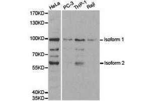 Western Blotting (WB) image for anti-Ubiquitin-Like with PHD and Ring Finger Domains 2, E3 Ubiquitin Protein Ligase (UHRF2) antibody (ABIN1875279) (UHRF2 anticorps)