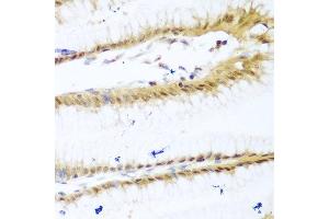 Immunohistochemistry of paraffin-embedded human stomach using UNG antibody at dilution of 1:100 (40x lens). (UNG anticorps)