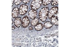 Immunohistochemical staining (Formalin-fixed paraffin-embedded sections) of human colon shows granular cytoplasmic positivity in glandular cells. (OTC anticorps)