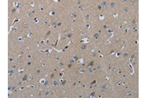 The image on the left is immunohistochemistry of paraffin-embedded Human brain tissue using ABIN7129423(FAAH Antibody) at dilution 1/50, on the right is treated with fusion protein. (FAAH anticorps)