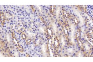Detection of CASR in Mouse Kidney Tissue using Polyclonal Antibody to Calcium Sensing Receptor (CASR) (CASR anticorps  (AA 863-1079))