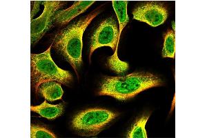This antibody stained U-2 OS and U-251 MG cells.