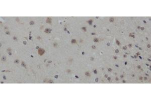 Immunohistochemistry of paraffin-embedded Mouse brain using IL4 Polyclonal Antibody at dilution of 1:50