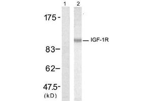 Western blot analysis of extract from 293 cells, using IGF-1R (Ab-1346) antibody (E021303, Lane 1 and 2). (IGF1R anticorps)