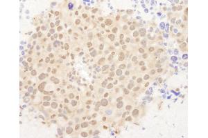 Immunohistochemistry (IHC) image for anti-Forkhead Box O3 (FOXO3) (C-Term) antibody (ABIN7448571)