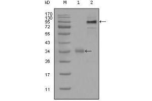 Western blot analysis using ETV1 mouse mAb against truncated Trx-ETV1 recombinant protein (1) and full-length ETV1 (aa1-477)-hIgGFc transfected CHO-K1 cell lysate(2). (ETV1 anticorps  (AA 1-191))