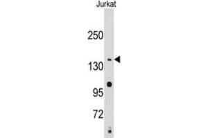 Western Blotting (WB) image for anti-Structural Maintenance of Chromosomes 2 (SMC2) antibody (ABIN2995231) (SMC2 anticorps)
