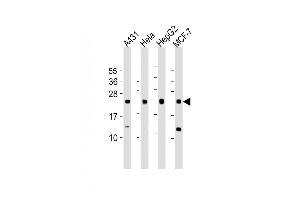 All lanes : Anti-LITAF Antibody (N-Term) at 1:1000 dilution Lane 1: A431 whole cell lysate Lane 2: Hela whole cell lysate Lane 3: HepG2 whole cell lysate Lane 4: MCF-7 whole cell lysate Lysates/proteins at 20 μg per lane.