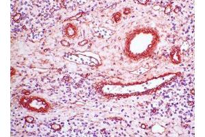 Image no. 1 for anti-Collagen, Type IV (COL4) antibody (ABIN481663) (Collagen IV anticorps)