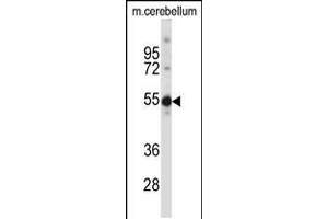 Western blot analysis in mouse cerebellum tissue lysates (35ug/lane). (TSPYL5 anticorps  (C-Term))