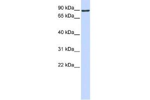 WB Suggested Anti-ATMIN Antibody Titration:  0. (ATM Interactor anticorps  (Middle Region))