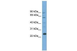 BCL7A antibody used at 1 ug/ml to detect target protein.