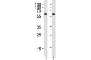 Western blot analysis of 1) human placenta and 2) mouse heart tissue lysate using PPARG antibody at 1:1000.
