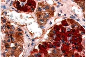 Anti-GHRHR antibody  ABIN1048653 IHC staining of human pituitary, anterior. (GHRHR anticorps  (Cytoplasmic Domain))