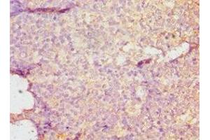 Immunohistochemistry of paraffin-embedded human tonsil tissue using ABIN7149695 at dilution of 1:100