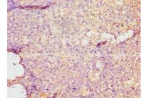 Immunohistochemistry of paraffin-embedded human tonsil tissue using ABIN7149695 at dilution of 1:100 (DMP1 anticorps  (AA 254-513))